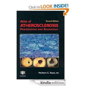 Atlas of Atherosclerosis Progression and Regression (Encyclopedia of 