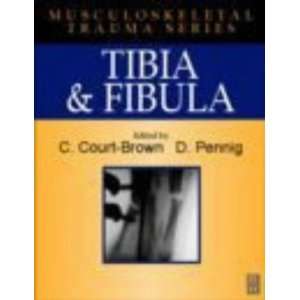  Tibia and Fibula (Musculoskeletal Trauma) (9780750649803 